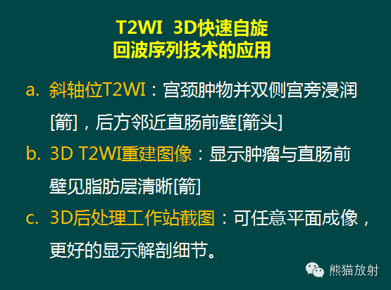 【PPT】子宫内膜癌及宫颈癌的MR扫描及评估【RG精选】 【PPT】子宫内膜癌及宫颈癌的MR扫描及评估【RG精选】