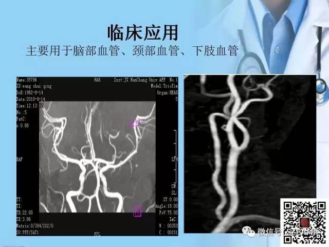 【PPT】磁共振血管成像技术的应用
