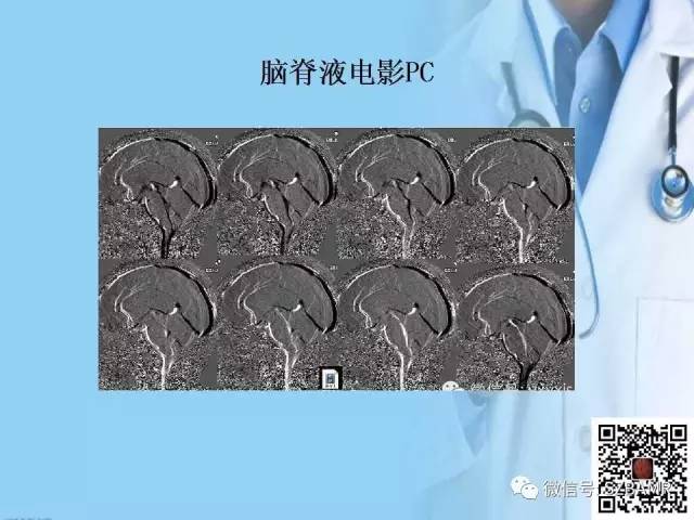 【PPT】磁共振血管成像技术的应用