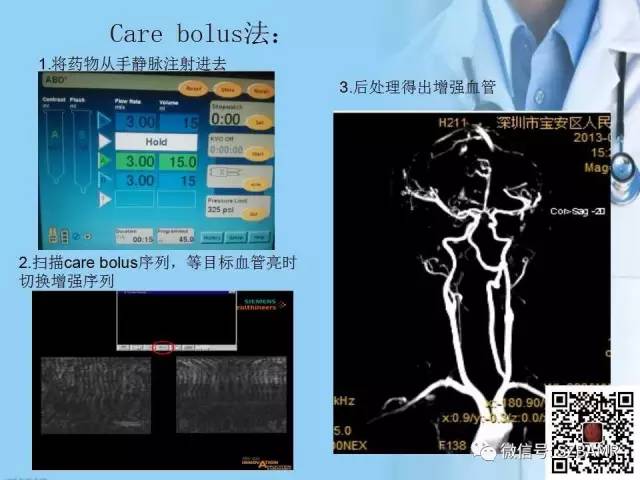 【PPT】磁共振血管成像技术的应用