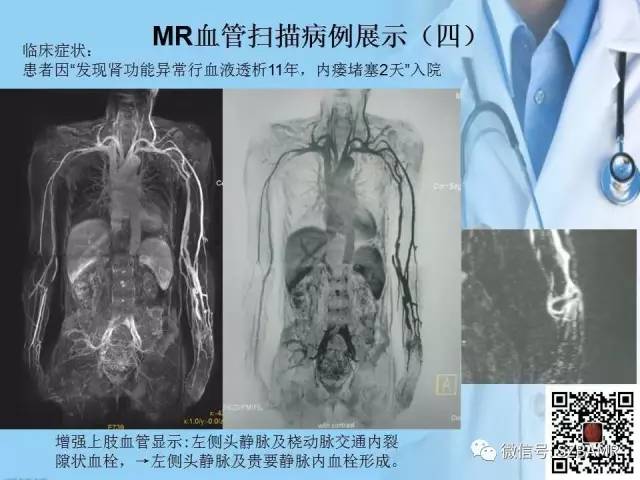 【PPT】磁共振血管成像技术的应用