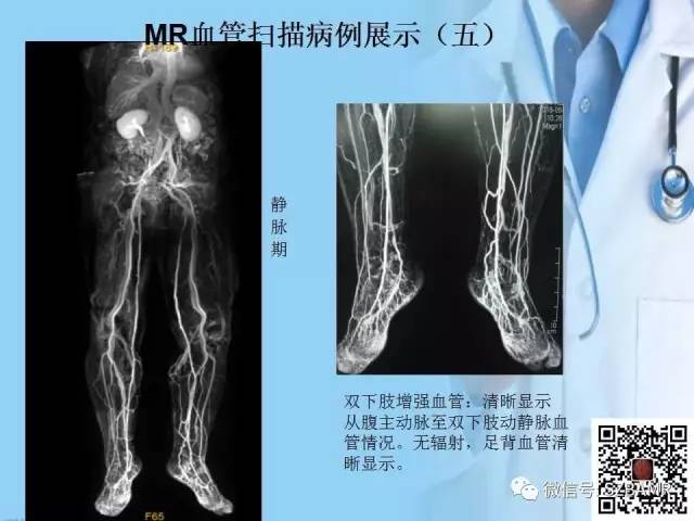 【PPT】磁共振血管成像技术的应用