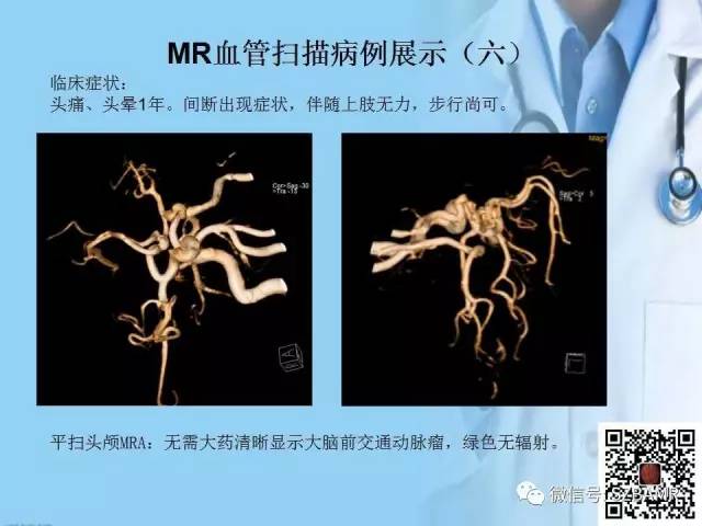 【PPT】磁共振血管成像技术的应用