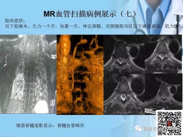 【PPT】磁共振血管成像技术的应用