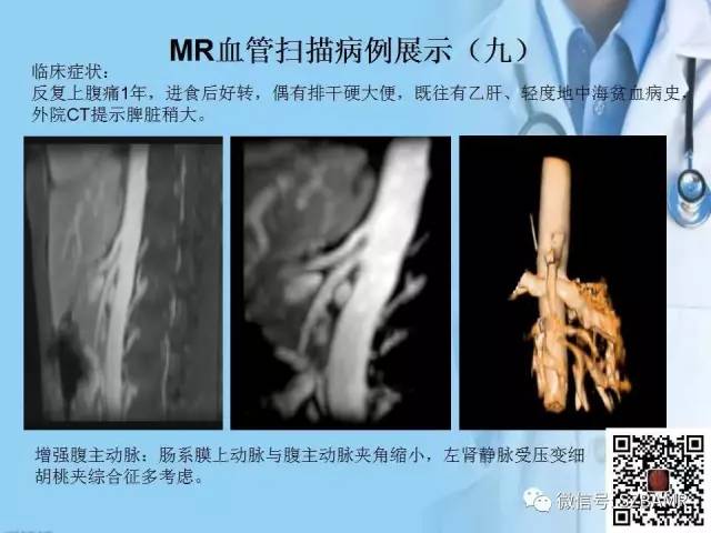 【PPT】磁共振血管成像技术的应用