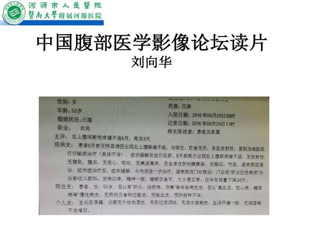 【病例】肝左叶内侧段高分化肝细胞性肝癌1例CT