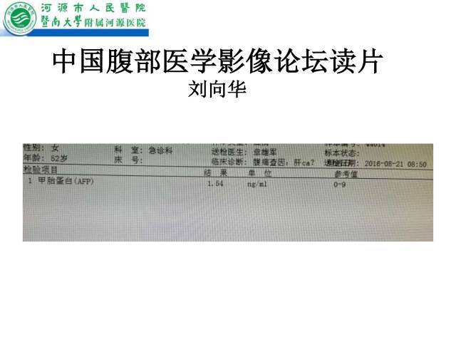 【病例】肝左叶内侧段高分化肝细胞性肝癌1例CT