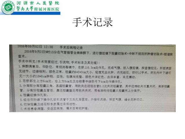 【病例】肝左叶内侧段高分化肝细胞性肝癌1例CT