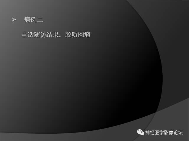 【病例】左颞叶胶质肉瘤1例MR影像表现 【病例】左颞叶胶质肉瘤1例MR影像表现