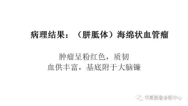 【病例】胼胝体海绵状血管瘤1例MR