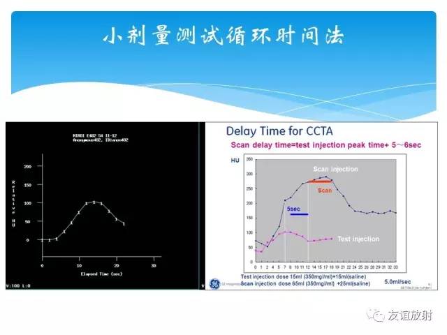 【PPT】冠脉(CTA)扫描方案