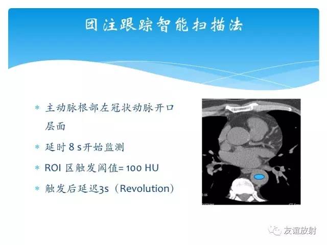 【PPT】冠脉(CTA)扫描方案