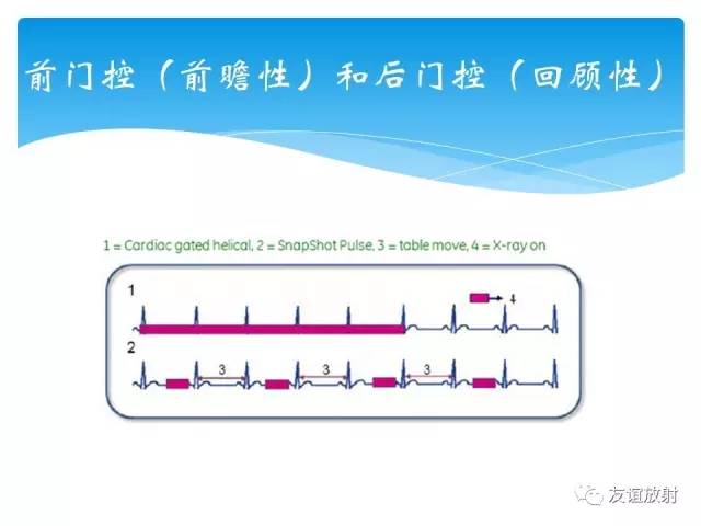 【PPT】冠脉(CTA)扫描方案