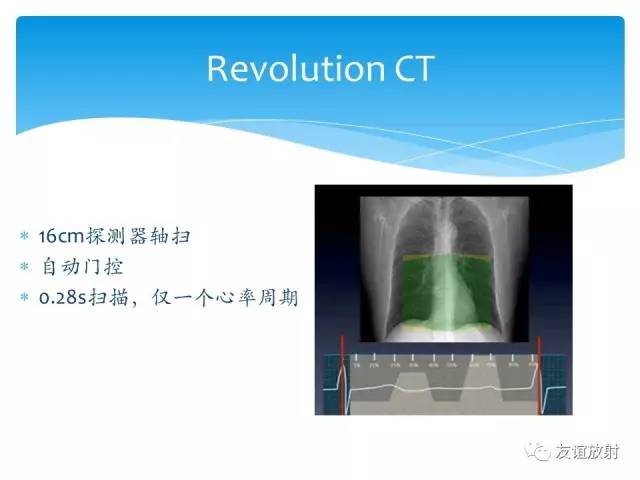 【PPT】冠脉(CTA)扫描方案