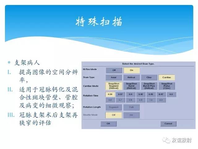 【PPT】冠脉(CTA)扫描方案