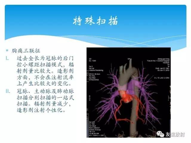 【PPT】冠脉(CTA)扫描方案
