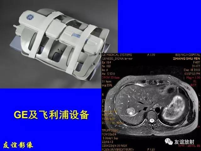 【PPT】肝胆胰脾常规MRI检查
