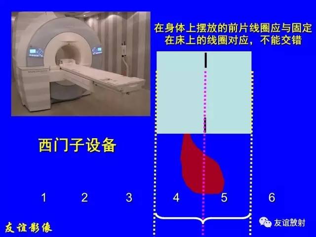 【PPT】肝胆胰脾常规MRI检查