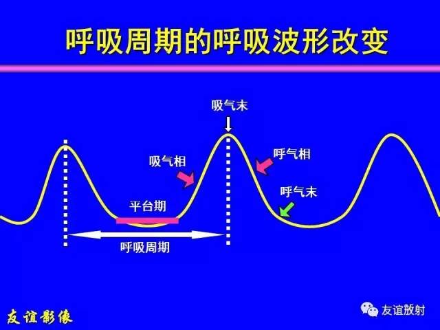 【PPT】肝胆胰脾常规MRI检查