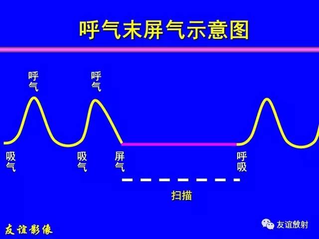 【PPT】肝胆胰脾常规MRI检查