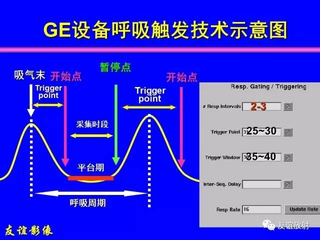 【PPT】肝胆胰脾常规MRI检查