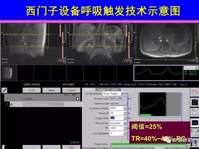 【PPT】肝胆胰脾常规MRI检查