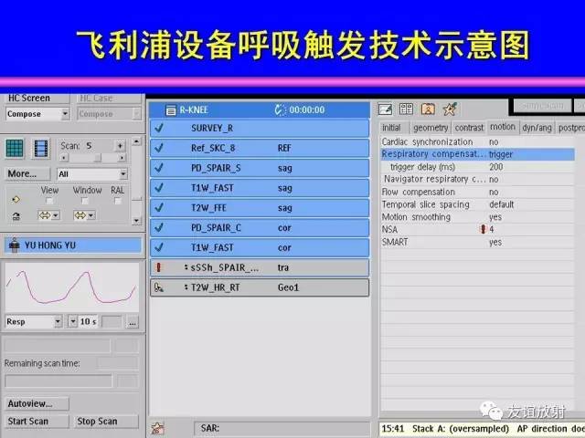 【PPT】肝胆胰脾常规MRI检查