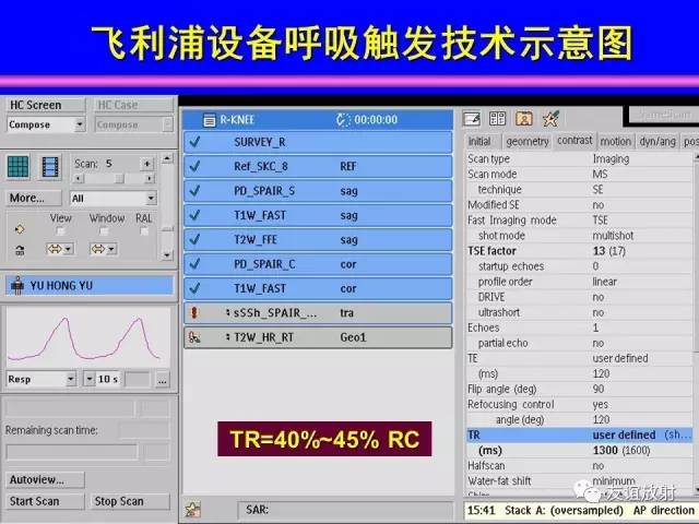 【PPT】肝胆胰脾常规MRI检查