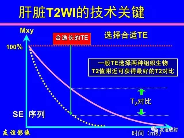 【PPT】肝胆胰脾常规MRI检查