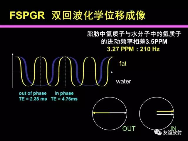 【PPT】肝胆胰脾常规MRI检查