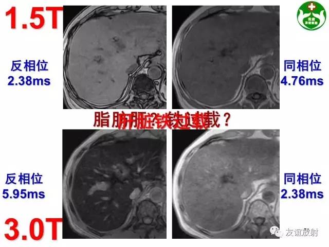 【PPT】肝胆胰脾常规MRI检查
