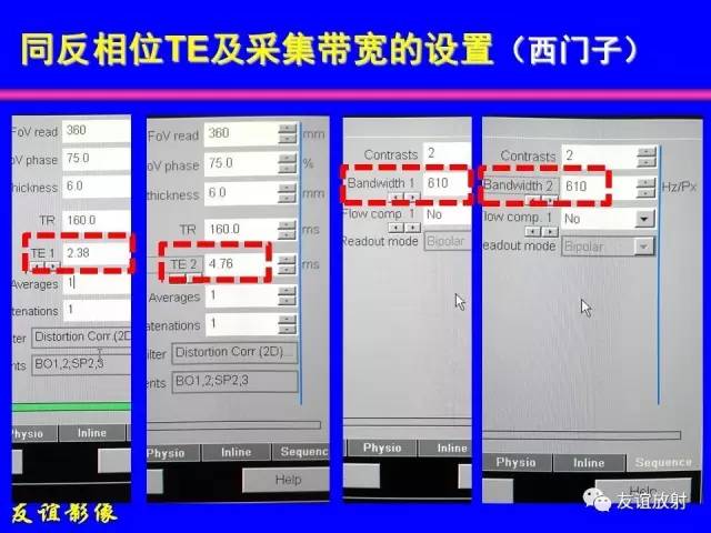 【PPT】肝胆胰脾常规MRI检查