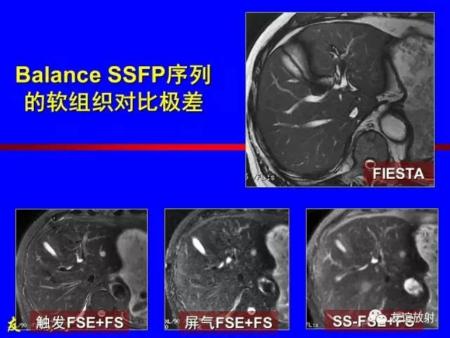 【PPT】肝胆胰脾常规MRI检查