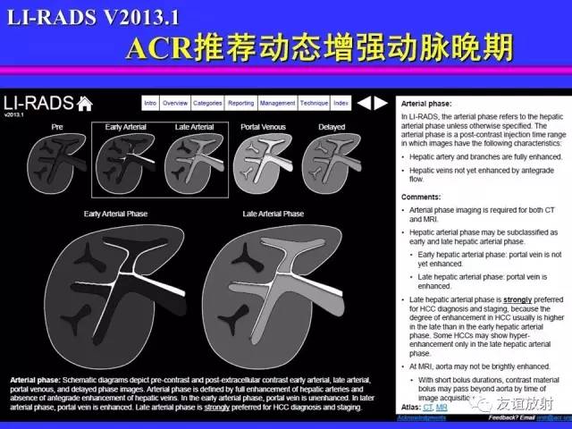 【PPT】肝胆胰脾常规MRI检查
