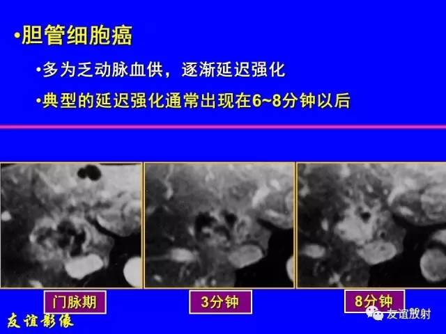 【PPT】肝胆胰脾常规MRI检查