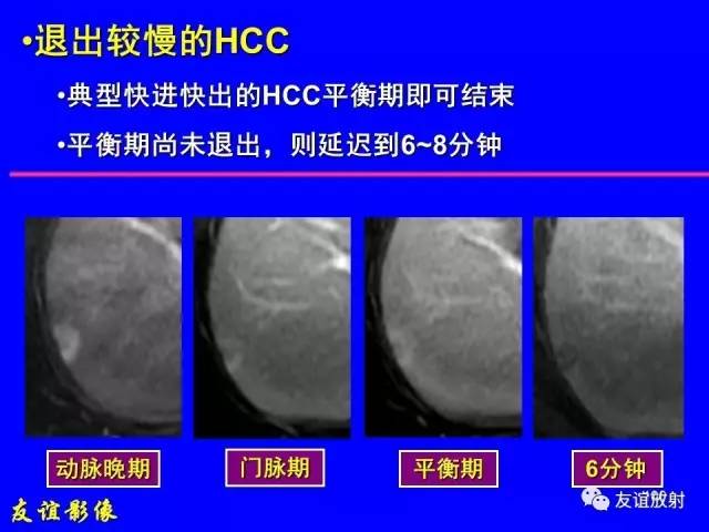 【PPT】肝胆胰脾常规MRI检查