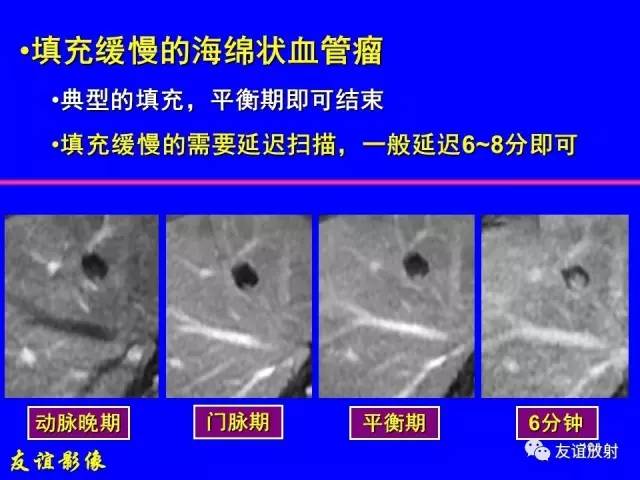 【PPT】肝胆胰脾常规MRI检查