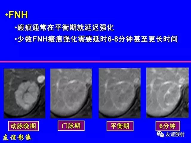 【PPT】肝胆胰脾常规MRI检查