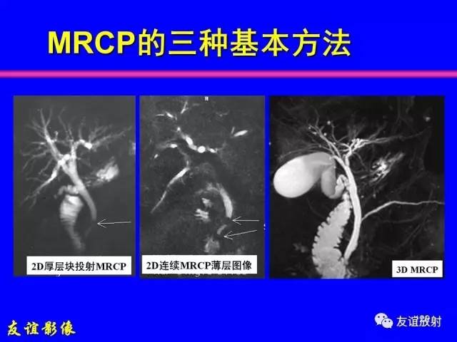 【PPT】肝胆胰脾常规MRI检查