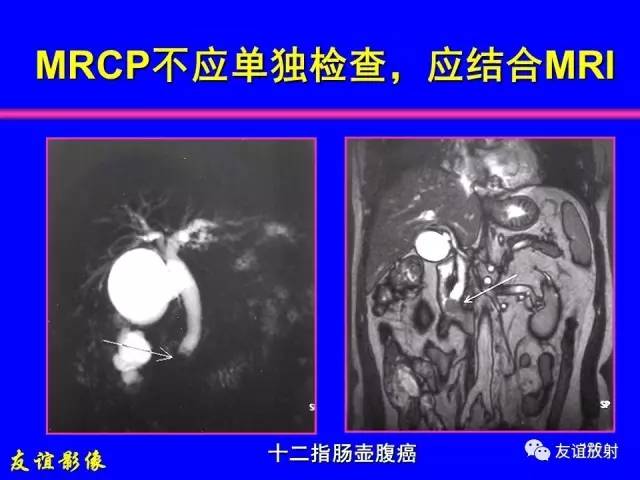 【PPT】肝胆胰脾常规MRI检查