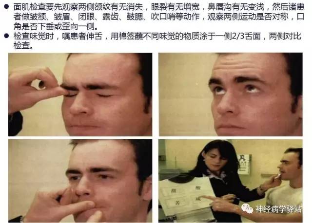 【PPT】面神经解剖、影像 【PPT】面神经解剖、影像