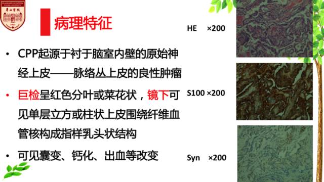 【病例】脉络丛乳头状瘤1例MR影像诊断与鉴别 【病例】脉络丛乳头状瘤1例MR影像诊断与鉴别