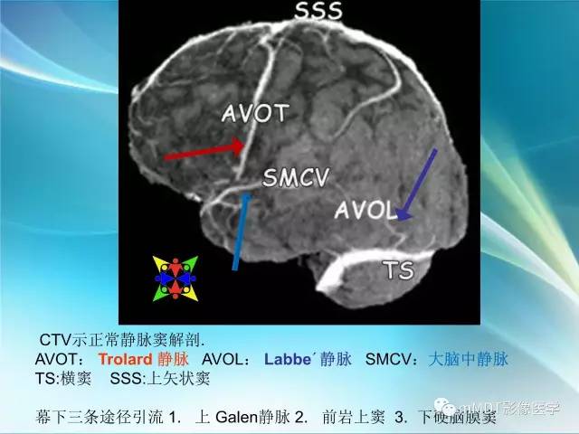 【PPT】脑静脉及静脉窦血栓影像诊断