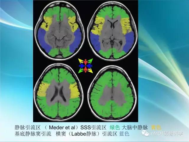 【PPT】脑静脉及静脉窦血栓影像诊断