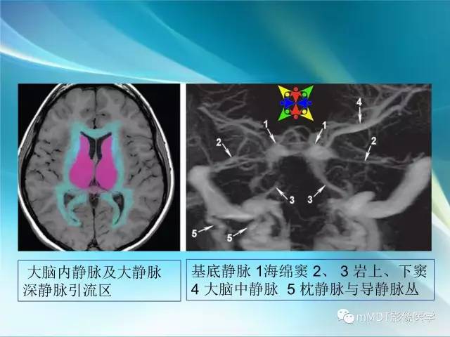 【PPT】脑静脉及静脉窦血栓影像诊断