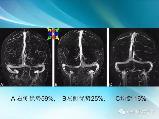 【PPT】脑静脉及静脉窦血栓影像诊断