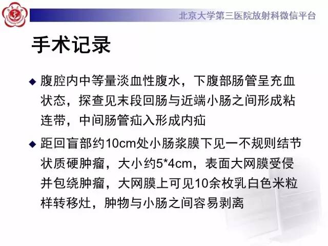 【病例】肠系膜纤维瘤病1例CT影像表现