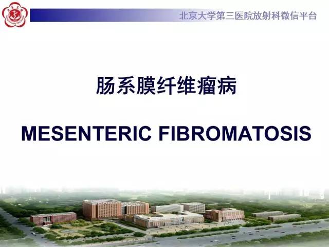 【病例】肠系膜纤维瘤病1例CT影像表现