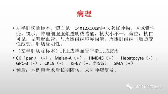 【PPT】肝上皮样血管平滑肌脂肪瘤诊断与鉴别