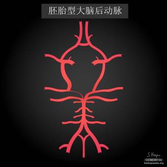 大脑Willis环的解剖及变异 大脑Willis环的解剖及变异